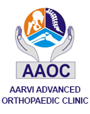 Aarvi